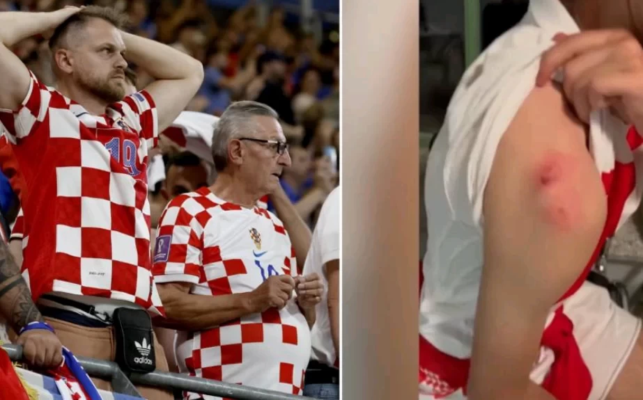 Police report a woman bit a Croatian fan while trying to grab a player’s jersey after the game